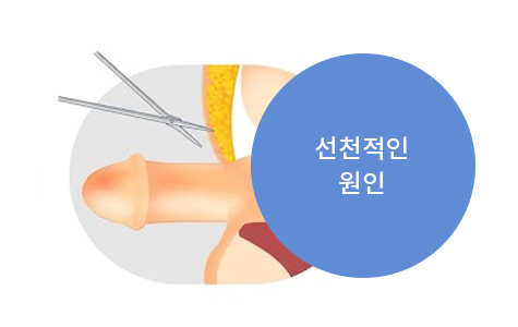 선천적인 원인