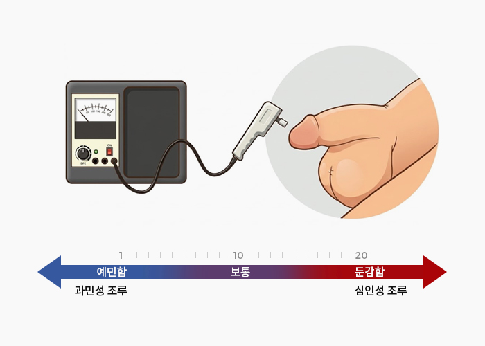 음경 진동각 검사 민감도 척도