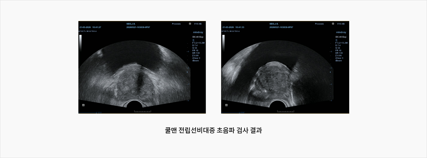 전립선비대증과 성기능 장애